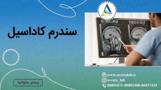 سندرم کاداسیل