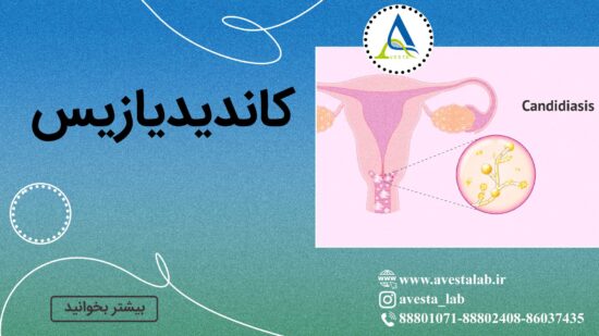 کاندیدیازیس