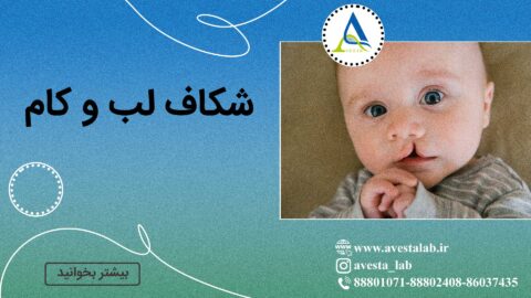 شکاف لب و کام