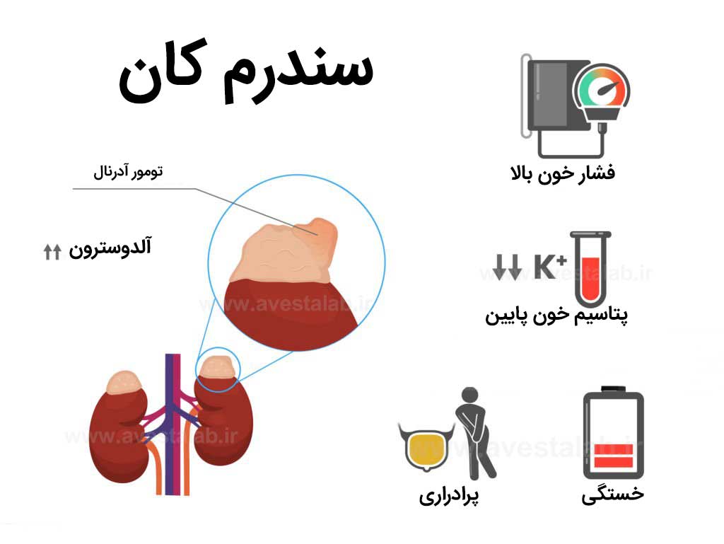 آلدوسترونیسم اولیه (سندرم کان)