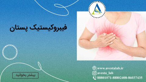 فیبروکیستیک پستان