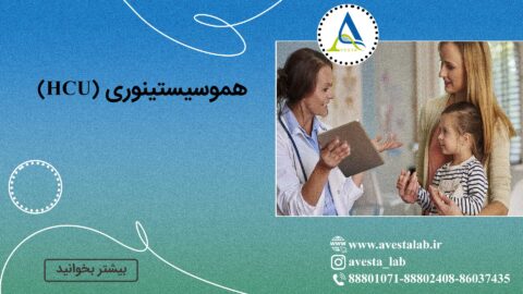 هموسیستینوری (HCU)