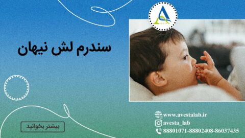 سندرم لش نیهان