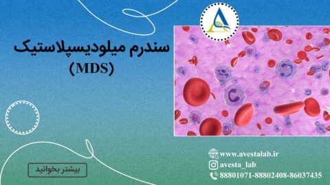 سندرم میلودیسپلاستیک (MDS)