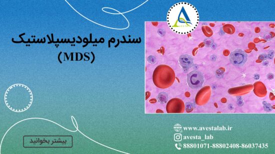 سندرم میلودیسپلاستیک (MDS)