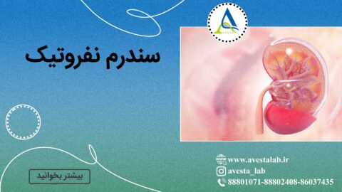 سندرم نفروتیک