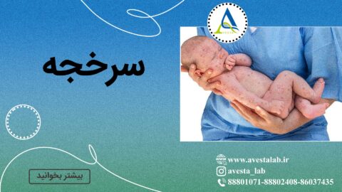 سرخجه