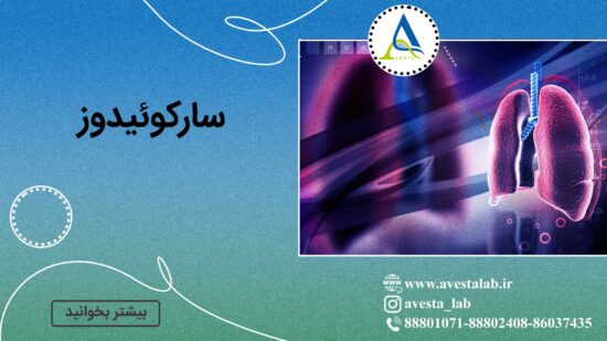 سارکوئیدوز