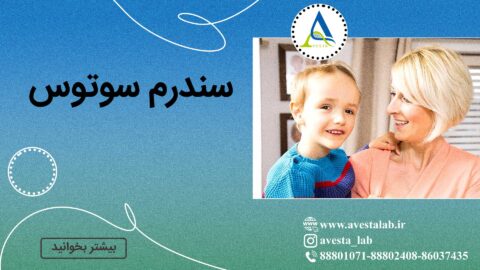 سندرم سوتوس