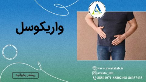 واریکوسل