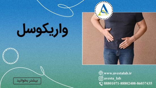 واریکوسل