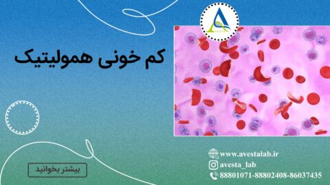 کم خونی همولیتیک