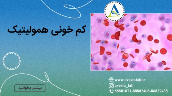 کم خونی همولیتیک