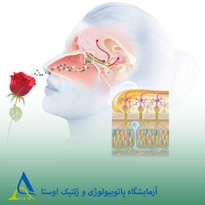 سندرم کالمن