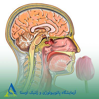 سندرم کالمن