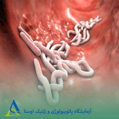 انگل چیست؟