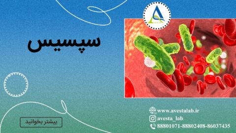 سپسیس
