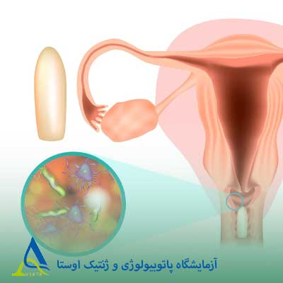 واژینیت
