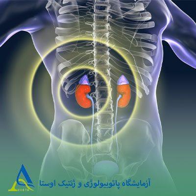 غدد فوق کلیوی