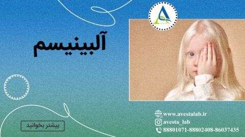 آلبینیسم