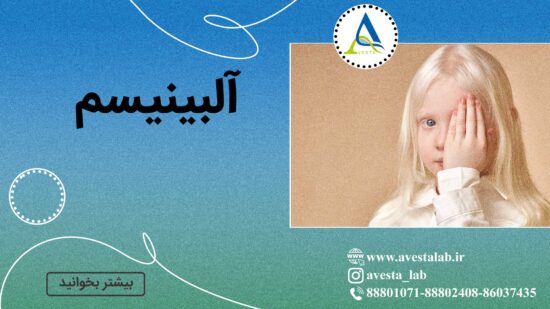 آلبینیسم