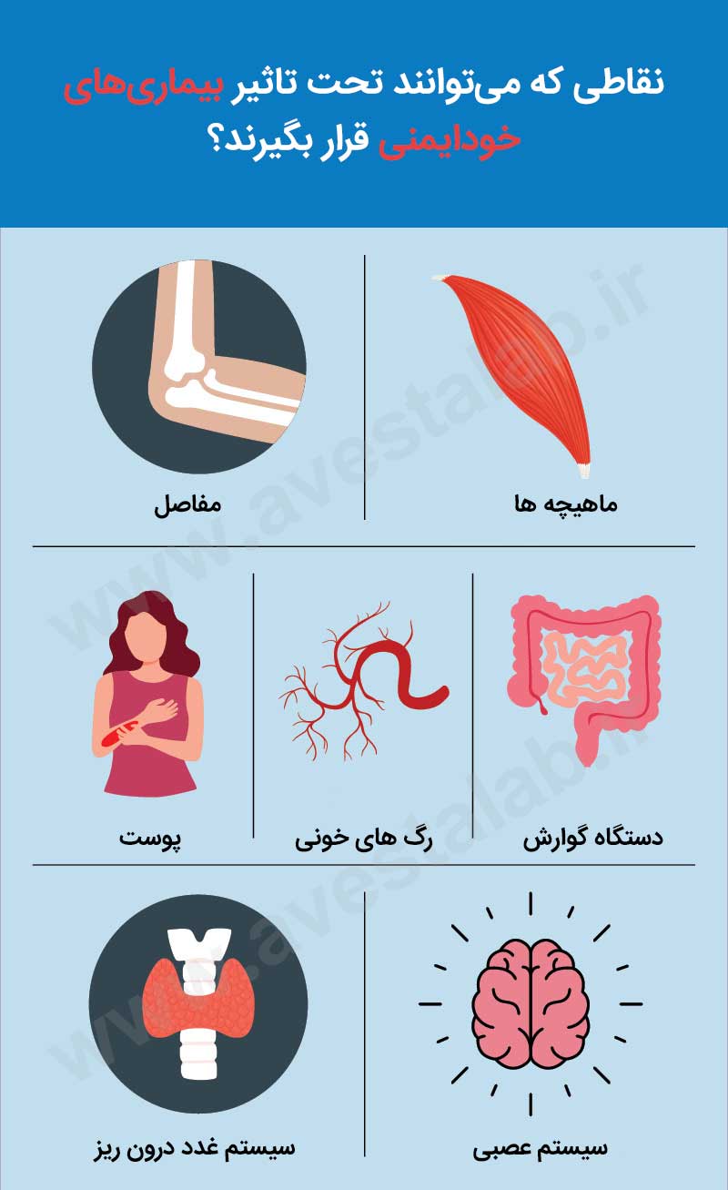 بیماری های خودایمنی