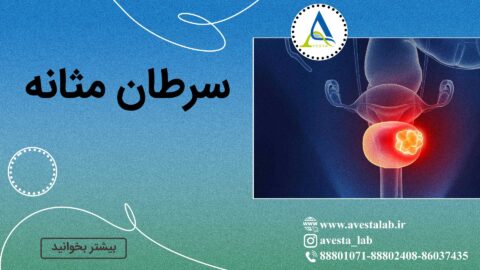 سرطان مثانه