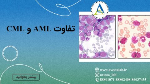 تفاوت AML و CML