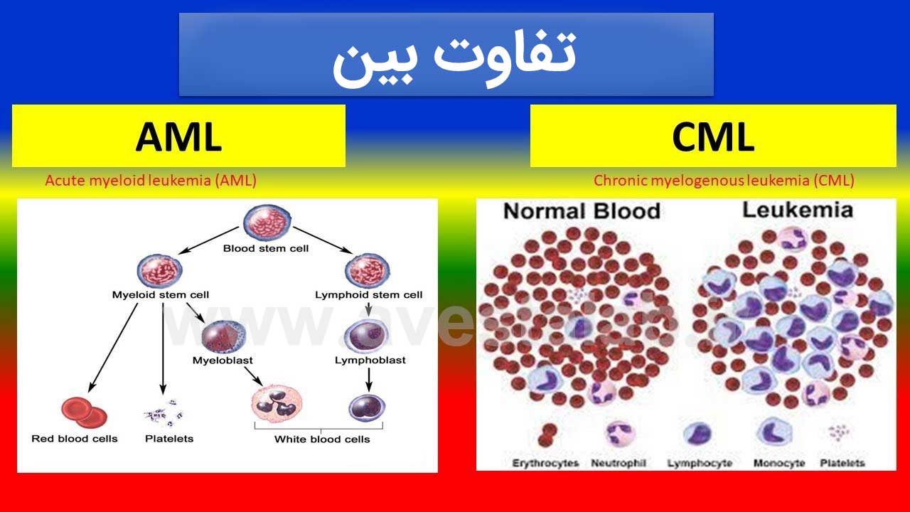 تفاوت AML و CML