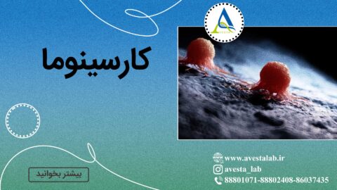 کارسینوما