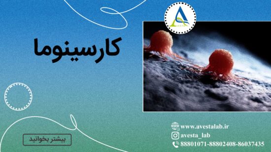 کارسینوما