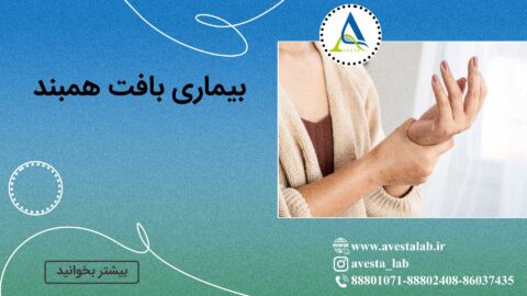 بیماری بافت همبند