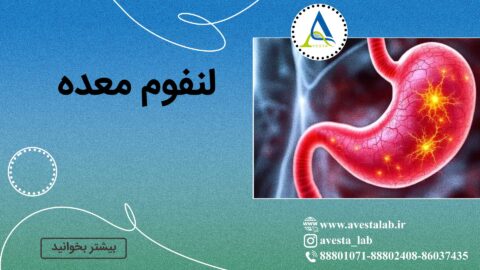 لنفوم معده