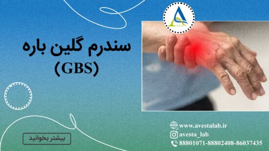 سندرم گلین باره (GBS)