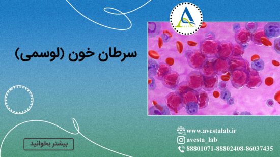 سرطان خون (لوسمی)