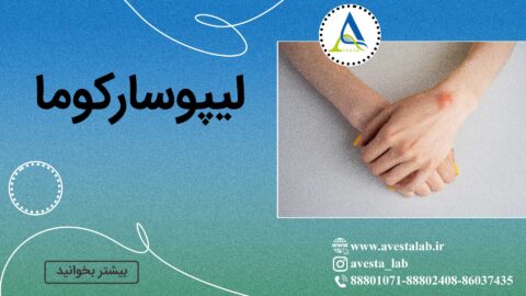 لیپوسارکوم