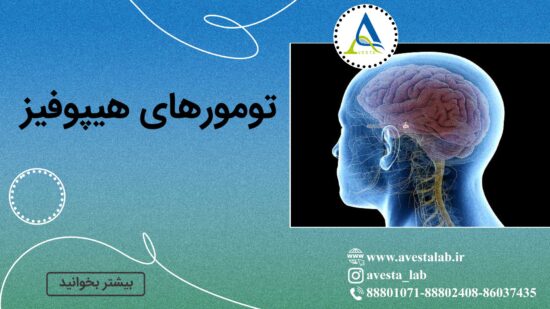 تومورهای هیپوفیز
