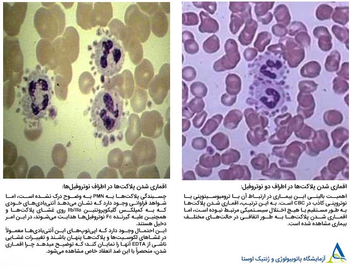 Platelet satellitism