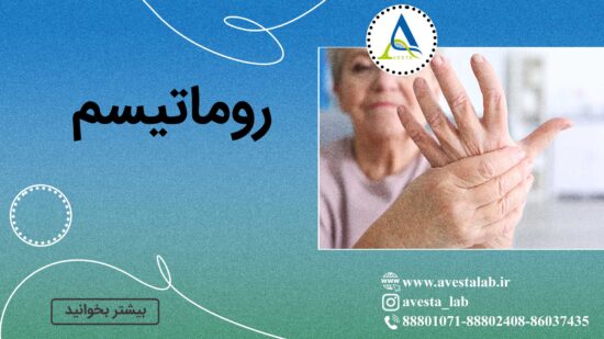 روماتیسم