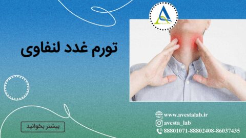 تورم غدد لنفاوی
