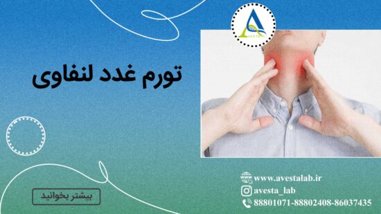 تورم غدد لنفاوی