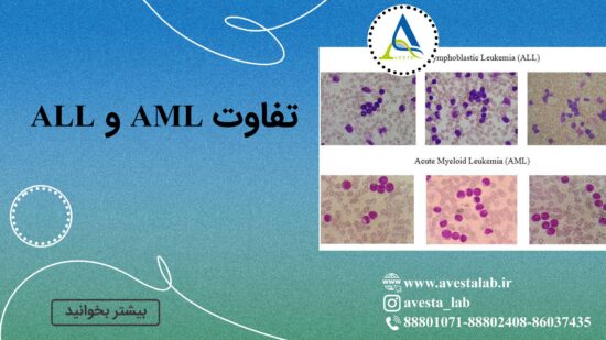 تفاوت AML و ALL