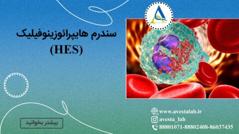 سندرم هایپرائوزینوفیلیک (HES)
