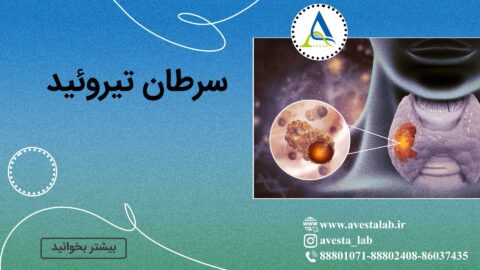 سرطان تیروئید