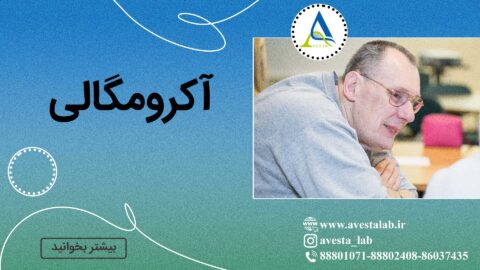 آکرومگالی
