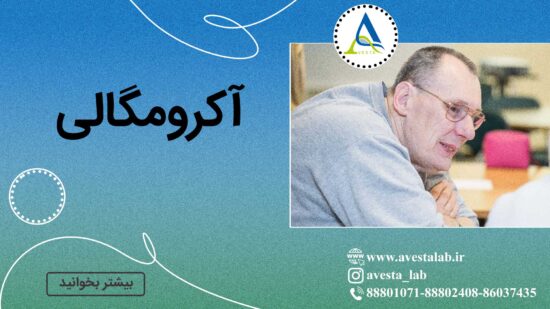 آکرومگالی