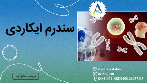 سندرم ایکاردی