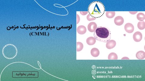 لوسمی میلومونوسیتیک مزمن (CMML)