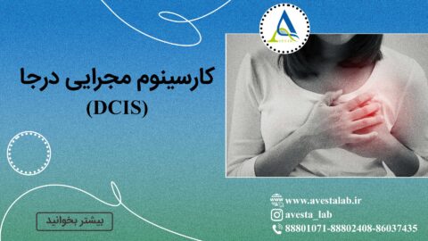 کارسینوم مجرایی درجا (DCIS)