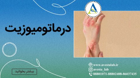 درماتومیوزیت